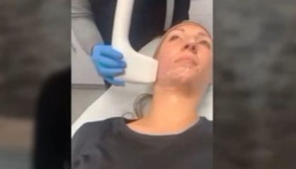 Sofwave™ Treatment Patient Testimonial Sofwave™ Treatment Patient Testimonial