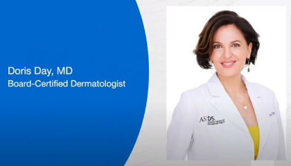 Doris Day MD video on Sofwave Doris Day MD video on Sofwave