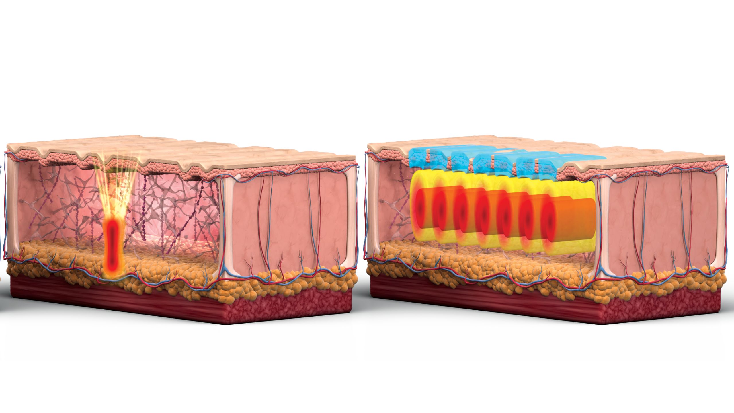 Comperative MOA Comperative MOA