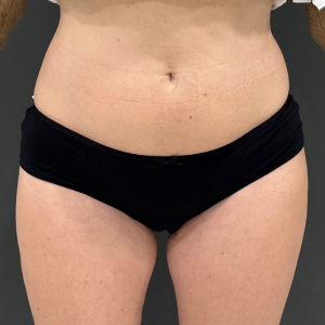 Pure impact 1 before