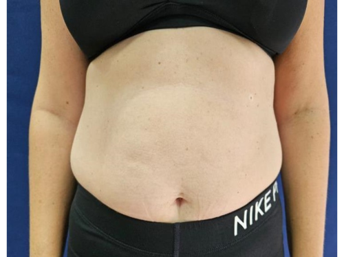 Pure impact 2 before