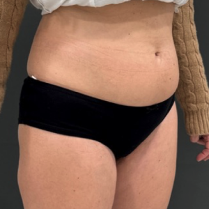 Pure impact 3 before